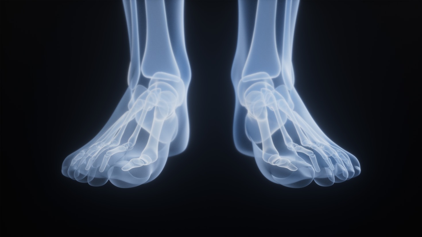 Top 7 Exercises to Relieve Plantar Fasciitis